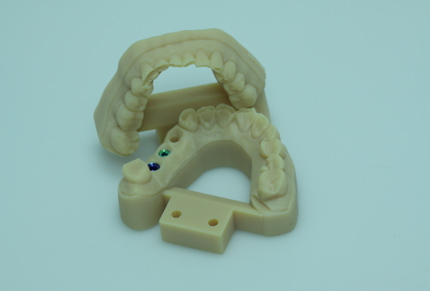 3d printed dental model with prosthetic guides