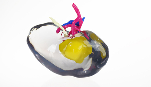3d printed medical models