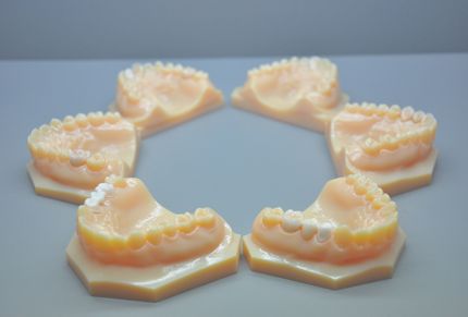 KTJ’s in-house 3D printer streamlined the customization of dental models, a crucial aspect of digital dentistry.