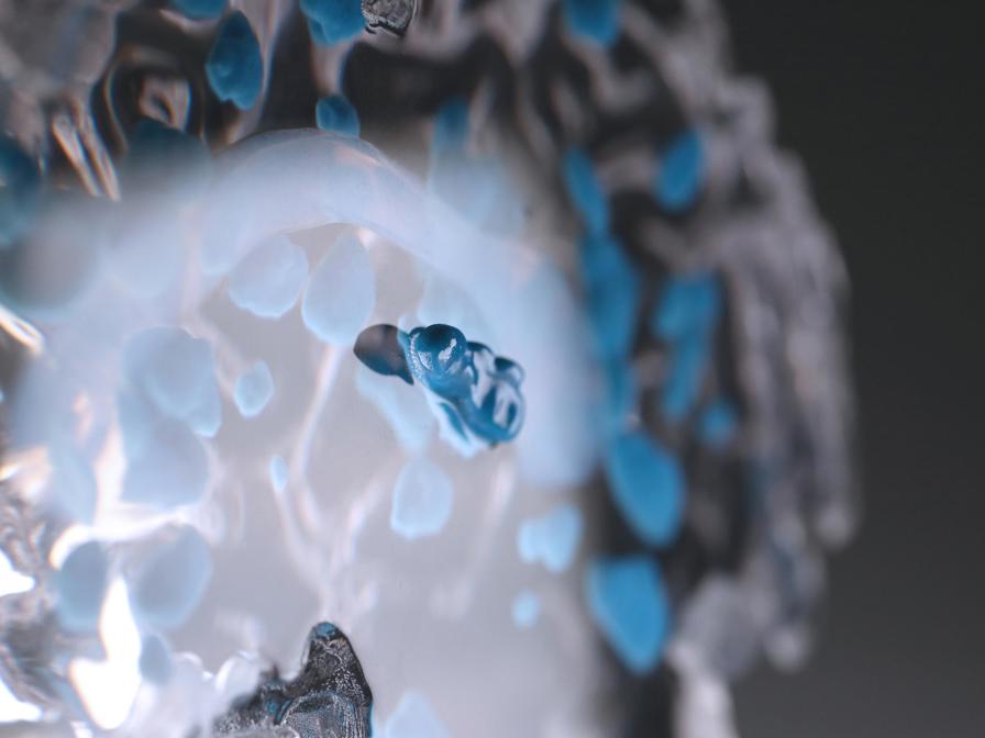 3D printed brain created from PolyJet materials showing lesions from MS (in blue)
