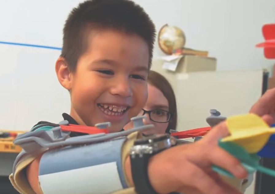 Noel has more freedom of movement and independence
thanks to his exoskeleton arms.