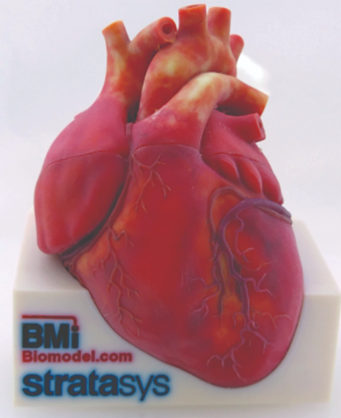 BMI’s heart model shows the Stratasys J750’s ability to print
realistic colors.  BMI’s heart model shows the Stratasys J750’s ability to print
realistic colors. 