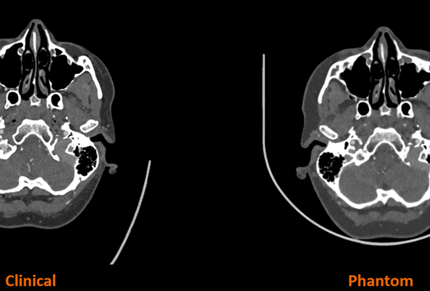 CT scan comparison