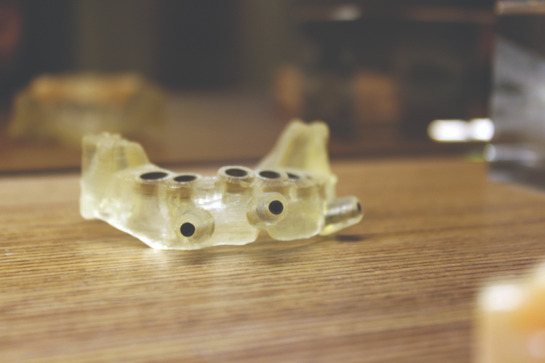 3D printed dental guides to accurately
locate implants.