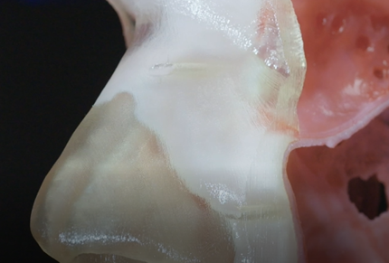 3D printed medical model of a nose. 