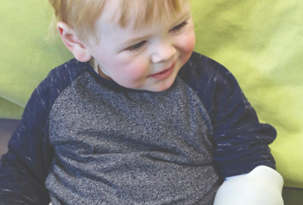 Child pictured with 3D printed arm. 