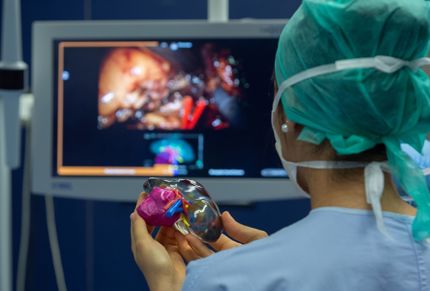 Trainee surgeon using a 3D printed model of a patient’s kidney in the operating theatre during a surgery.