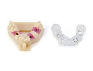 implantology