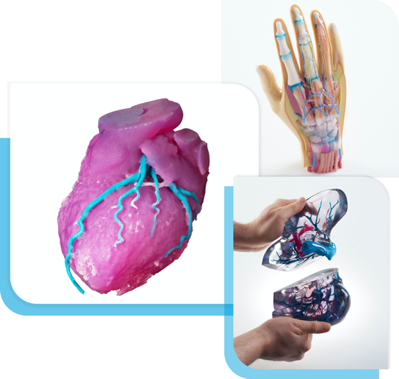 3D printed medical models