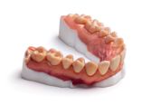 Dentures 3D printed with Statasys VeroVivid material