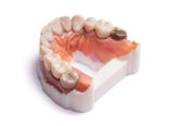 Dentures 3D printed with Statasys VeroVivid material