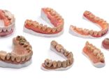 Dentures 3D printed with Statasys VeroVivid material