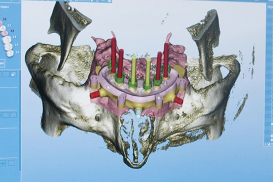 planning model printing with J3, using grabcad software