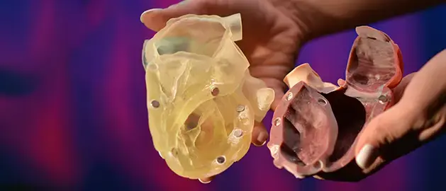 Hands holding two detailed 3D printed anatomical heart models, one translucent and one cut open to show internal structures.