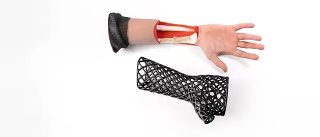 An anatomical forearm 3d printed model showing muscles and bones beside a black 3D-printed lattice wrist brace.
