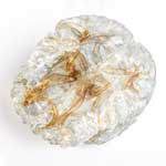 SLA Somos BioClear Anatomical Brain Model | Stratasys Direct