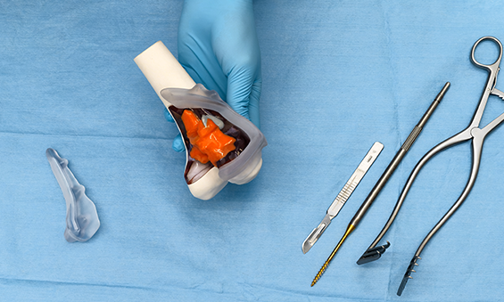 Blue gloved hand holding 3d printed medical model