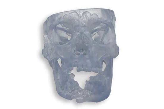 Stratasys Direct 3D Printed Anatomical Model in Somos BioClear Material