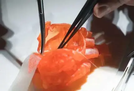 3D Printed surgical heart being operated on for surgery training