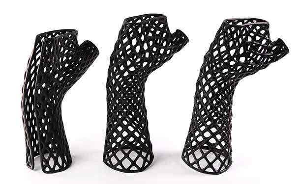 3D Printed Casts DLP P3 | Stratasys Direct